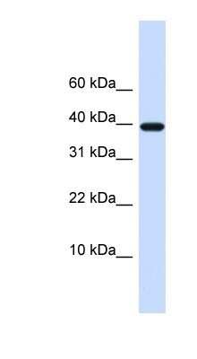 Western Blot: Chondromodulin-1/LECT1 Antibody [NBP1-59348] - 721_B cell lysate, concentration 0.2-1 ug/ml.