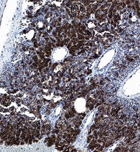 Chromogranin A was detected in immersion fixed paraffin-embedded sections of human parathyroid using Mouse Anti-Human Chromogranin A Monoclonal Antibody (Catalog # MAB9098) at 1.7 µg/mL overnight at 4 °C. Tissue was stained using the Anti-Mouse HRP-DAB Cell & Tissue Staining Kit (brown; Catalog # CTS002) and counterstained with hematoxylin (blue). Specific staining was localized to cytoplasm in chief cells. View our protocol for Chromogenic IHC Staining of Paraffin-embedded Tissue Sections.