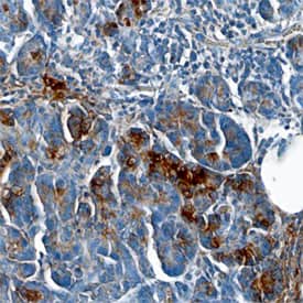 Immunohistochemistry Chymotrypsin C/CTRC Antibody