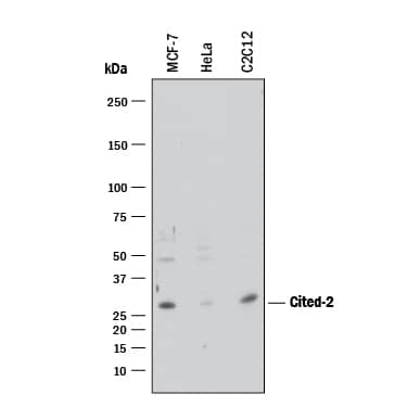 Western blot shows lysates of MCF-7 human breast cancer cell line, HeLa human cervical epithelial carcinoma cell line, and C2C12 mouse myoblast cell line. PVDF membrane was probed with 1 µg/mL of Sheep Anti-Human/Mouse Cited-2 Antigen Affinity-purified Polyclonal Antibody (Catalog # AF5005) followed by HRP-conjugated Anti-Sheep IgG Secondary Antibody (Catalog # HAF016). A specific band was detected for Cited-2 at approximately 30-35 kDa (as indicated). This experiment was conducted under reducing conditions and using Immunoblot Buffer Group 1.