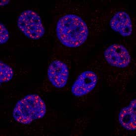 Cited-2 was detected in immersion fixed HeLa human cervical epithelial carcinoma cell line using Sheep Anti-Human/Mouse Cited-2 Antigen Affinity-purified Polyclonal Antibody (Catalog # AF5005) at 1 µg/mL for 3 hours at room temperature. Cells were stained using the NorthernLights™ 557-conjugated Anti-Sheep IgG Secondary Antibody (red; Catalog # NL010) and counterstained with DAPI (blue). Specific staining was localized to nuclei. View our protocol for Fluorescent ICC Staining of Cells on Coverslips.