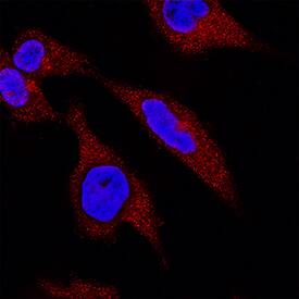 Claspin was detected in immersion fixed HeLa human cervical epithelial carcinoma cell line using Goat Anti-Human Claspin Antigen Affinity-purified Polyclonal Antibody (Catalog # AF3310) at 1.7 µg/mL for 3 hours at room temperature. Cells were stained using the NorthernLights™ 557-conjugated Anti-Goat IgG Secondary Antibody (red; Catalog # NL001) and counterstained with DAPI (blue). Specific staining was localized to cytoplasm. View our protocol for Fluorescent ICC Staining of Cells on Coverslips.