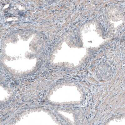 Immunohistochemistry-Paraffin: Collagen I alpha 1 Antibody [NBP1-82489] - Staining of human prostate shows weak cytoplasmic positivity in smooth muscle cells.