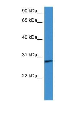 Western Blot: Complement Factor D/Adipsin Antibody [NBP1-79793] - Titration: 0.2-1 ug/ml, Positive Control: Human Lung.