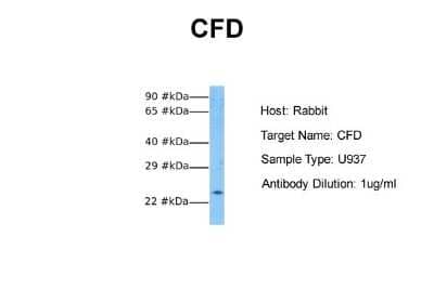 Western Blot: Complement Factor D/Adipsin Antibody [NBP1-79793] - Sample Tissue: Human U937 Antibody Dilution: 1.0 ug/ml