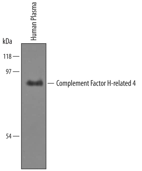 Western blot shows lysates of human plasma. PVDF Membrane was probed with 1 µg/mL of Sheep Anti-Human Complement Factor H-related 4/CFHR4 Antigen Affinity-purified Polyclonal Antibody (Catalog # AF5980) followed by HRP-conjugated Anti-Sheep IgG Secondary Antibody (Catalog # HAF016). A specific band was detected for Complement Factor H-related 4/CFHR4 at approximately 86 kDa (as indicated). This experiment was conducted under non-reducing conditions and using Immunoblot Buffer Group 1.