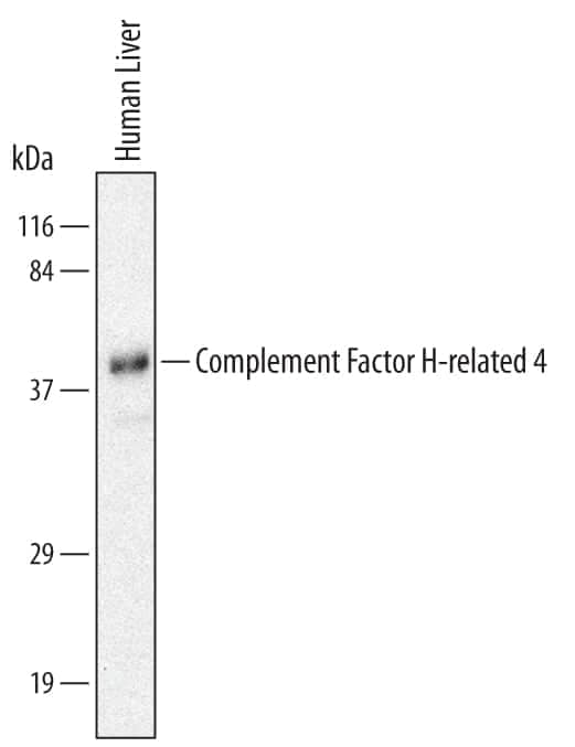 Western Blot Complement Factor H-related 4/CFHR4 Antibody (640212) [Unconjugated]