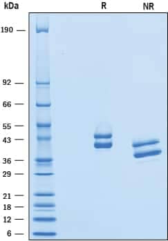 2 μg/lane of Recombinant Human Complement Factor H-related 1/CFHR1 was resolved with SDS-PAGE underreducing (R) and non-reducing (NR) conditions and visualized by Coomassie® Bluestaining, showing bands under reducing conditions at 41 kDa and 45 kDa.