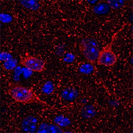 Complexin-1/2 was detected in immersion fixed mouse brain (cortex) using Goat Anti-Human/Mouse/Rat Complexin-1/2 Antigen Affinity-purified Polyclonal Antibody (Catalog # AF7787) at 15 µg/mL for 3 hours at room temperature. Cells were stained using the NorthernLights™ 557-conjugated Anti-Goat IgG Secondary Antibody (red; Catalog # NL001) and counterstained with DAPI (blue). Specific staining was localized to cytoplasm in neurons. View our protocol for Fluorescent IHC Staining of Frozen Tissue Sections.