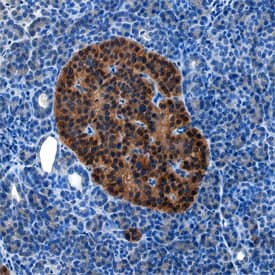 Complexin-1/2 was detected in immersion fixed paraffin-embedded sections of human pancreas using Mouse Anti-Human/Mouse/Rat Complexin-1/2 Monoclonal Antibody (Catalog # MAB8069) at 15 µg/mL overnight at 4 °C. Before incubation with the primary antibody, tissue was subjected to heat-induced epitope retrieval using Antigen Retrieval Reagent-Basic (Catalog # CTS013). Tissue was stained using the Anti-Mouse HRP-DAB Cell & Tissue Staining Kit (brown; Catalog # CTS002) and counterstained with hematoxylin (blue). Specific staining was localized to islets. View our protocol for Chromogenic IHC Staining of Paraffin-embedded Tissue Sections.