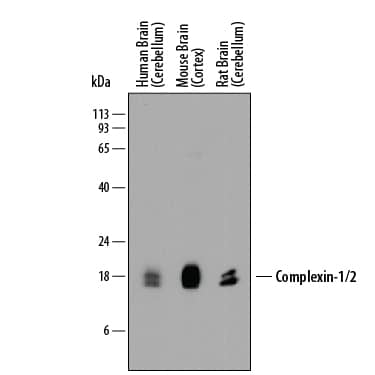Western blot shows lysates of human brain (cerebellum) tissue, mouse brain (cortex) tissue, and rat brain (cerebellum) tissue. PVDF membrane was probed with 0.5 µg/mL of Mouse Anti-Human/Mouse/Rat Complexin-1/2 Monoclonal Antibody (Catalog # MAB8069) followed by HRP-conjugated Anti-Mouse IgG Secondary Antibody (Catalog # HAF018). Specific bands were detected for Complexin-1/2 at approximately 17-19 kDa (as indicated). This experiment was conducted under reducing conditions and using Immunoblot Buffer Group 1.