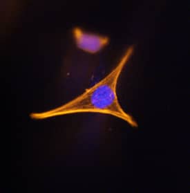 Immunocytochemistry Corin Antibody (231443) [Unconjugated]