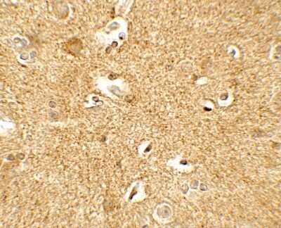 Immunohistochemistry-Paraffin: Corticotropin Releasing Factor Antibody [NBP2-41273] - Human brain tissue with Corticotropin Releasing Factor antibody at 5 ug/mL.