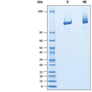 2 μg/lane of Recombinant Human F. tularensis Cpt1 Protein (Catalog # 10343-C1) was  resolved with SDS-PAGE under reducing (R) and non-reducing (NR)  conditions and visualized by Coomassie® Blue staining, showing bands at 110-135 kDa.