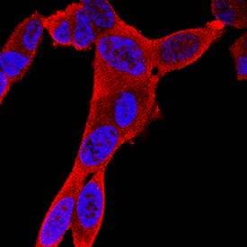 Creatine Kinase BB was detected in immersion fixed SH-SY5Y human neuroblastoma cell line using Mouse Anti-Human/Mouse/Rat Creatine Kinase BB Monoclonal Antibody (Catalog # MAB9076) at 8 µg/mL for 3 hours at room temperature. Cells were stained using the NorthernLights™ 557-conjugated Anti-Mouse IgG Secondary Antibody (red; Catalog # NL007) and counterstained with DAPI (blue). Specific staining was localized to cytoplasm. View our protocol for Fluorescent ICC Staining of Cells on Coverslips.