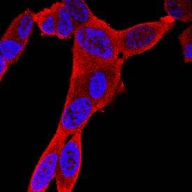     Creatine  Kinase BB was detected in immersion fixed SH‑SY5Y human  neuroblastoma cell line using Mouse Anti-Human/Mouse/Rat Creatine Kinase BB Monoclonal  Antibody (Catalog # MAB9076) at 8 µg/mL for 3 hours at  room temperature. Cells were stained using the NorthernLights™  557-conjugated Anti-Mouse IgG Secondary Antibody (red; Catalog #  NL007)  and counterstained with DAPI (blue). Specific staining was localized to  cytoplasm. View our protocol for Fluorescent  ICC Staining of Cells on Coverslips. 