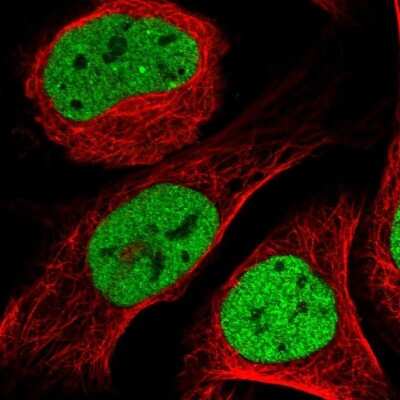 Immunocytochemistry/Immunofluorescence: CtBP1 Antibody [NBP1-88707] - Immunofluorescent staining of human cell line U-2 OS shows localization to nucleoplasm.