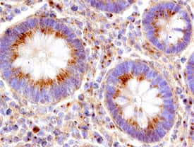 Cyclin B2 was detected in immersion fixed paraffin-embedded sections of human colon using Sheep Anti-Human Cyclin B2 Antigen Affinity-purified Polyclonal Antibody (Catalog # AF6204) at 15 µg/mL overnight at 4 °C. Before incubation with the primary antibody, tissue was subjected to heat-induced epitope retrieval using Antigen Retrieval Reagent-Basic (Catalog # CTS013). Tissue was stained using the Anti-Sheep HRP-DAB Cell & Tissue Staining Kit (brown; Catalog # CTS019) and counterstained with hematoxylin (blue). Specific staining was localized to epithelial cells in mucosal glands. View our protocol for Chromogenic IHC Staining of Paraffin-embedded Tissue Sections.