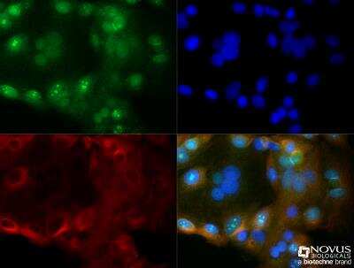 <b>Biological Strategies Validation. </b>Immunocytochemistry/Immunofluorescence: Cyr61/CCN1 Antibody [NB100-356] - MCF7 cells were fixed for 10 minutes using 10% formalin and then permeabilized for 5 minutes using 1X TBS + 0.5% Triton X-100. The cells were incubated with anti-Cyr61/CCN1 (NB100-356) at 1:200 overnight at 4C and detected with an anti-rabbit DyLight 488 (Green) at 1:500. Alpha tubulin was used as a co-stain at 1:1000 and detected with an anti-mouse DyLight 550 (Red) at a 1:500 dilution. Nuclei were counterstained with DAPI (Blue). Cells were imaged using a 40X objective.