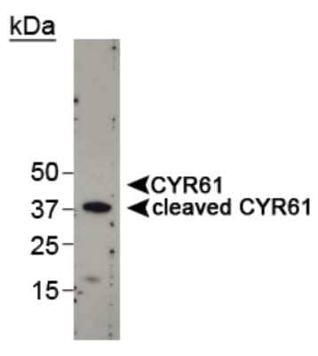 Western Blot: Cyr61/CCN1 Antibody [NB100-356] - Detection of cleaved CYR61 in MDA-MB-231 cell lysate using NB 100-356. Photo courtesy of Dr. Lupu's Lab, Northwestern University. Image by Dr. Ingrid Espinoza.