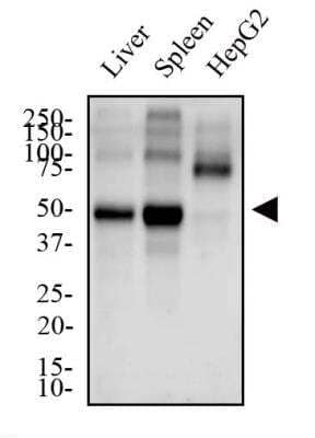 Western Blot: Cyr61/CCN1 Antibody [NB100-356] - Total protein from Human liver, spleen and HepG2 cells was separated on a 12% gel by SDS-PAGE, transferred to PVDF membrane and blocked in 5% non-fat milk in TBST. The membrane was probed with 2.0 ug/mL anti-CYR61 in 1% non-fat milk in TBST and detected with an anti-rabbit HRP secondary antibody using chemiluminescence. Note the low expression level of CYR61 in HepG2 cells.