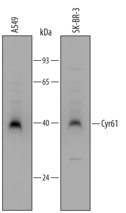 Western blot shows lysates of A549 human lung carcinoma cell line and SK-BR-3 human breast cancer cell line. PVDF Membrane was probed with 1 µg/mL of Sheep Anti-Human Cyr61/CCN1 Antigen Affinity-purified Polyclonal Antibody (Catalog # AF6009) followed by HRP-conjugated Anti-Sheep IgG Secondary Antibody (Catalog # HAF016). A specific band was detected for Cyr61/CCN1 at approximately 40 kDa (as indicated). This experiment was conducted under reducing conditions and using Immunoblot Buffer Group 2.