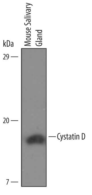 Western blot shows lysates of mouse salivary gland tissue. PVDF Membrane was probed with 2 µg/mL of Mouse Cystatin D/Cst10 Antigen Affinity-purified Polyclonal Antibody (Catalog # AF6255) followed by HRP-conjugated Anti-Sheep IgG Secondary Antibody (Catalog # HAF016). A specific band was detected for Cystatin D/Cst10 at approximately 17 kDa (as indicated). This experiment was conducted under reducing conditions and using Immunoblot Buffer Group 8.