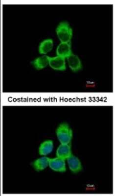 Cytoglobin Antibody (NBP2-16084): Novus Biologicals