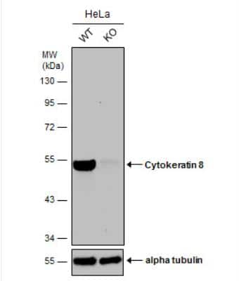 Knockout Validated: Cytokeratin 8 Antibody [NBP2-16094] - Wild-type (WT) and Cytokeratin 8 knockout (KO) HeLa cell extracts (30 ug) were separated by 10% SDS-PAGE, and the membrane was blotted with Cytokeratin 8 antibody. HRP-conjugated anti-rabbit IgG antibody (NBP2-19301) was used to detect the primary antibody.