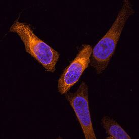 Cytokeratin 19 was detected in formaldehyde fixed HeLa human cervical epithelial carcinoma cell line using Sheep Anti-Human Cytokeratin 19 Biotinylated Antigen Affinity-purified Polyclonal Antibody (Catalog # BAF3506) at 15 µg/mL for 3 hours at room temperature. Cells were stained using the NorthernLights™ 557-conjugated Streptavidin (orange; Catalog # NL999) and counterstained with DAPI (blue). Specific staining was localized to intermediate filaments. View our protocol for Fluorescent ICC Staining of Cells on Coverslips.