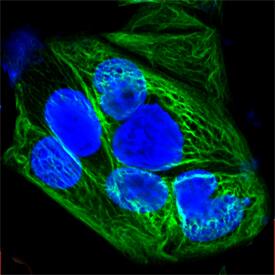 Cytokeratin 19 was detected in formaldehyde fixed MCF‑7 human breast cancer cell line using Sheep Anti-Human Cytokeratin 19 Alexa Fluor® 488‑conjugated Antigen Affinity-purified Polyclonal Antibody (green; Catalog # IC3506G) at 1:10 dilution overnight at 4 ° C and counterstained with DAPI (blue). Specific staining was localized to intermediate filaments. View our protocol for Fluorescent ICC Staining of Cells on Coverslips.