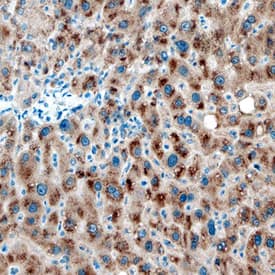 Cytosolic Sulfotransferase 1B1/SULT1B1 was detected in immersion fixed paraffin-embedded sections of human liver using Mouse Anti-Human Cytosolic Sulfotransferase 1B1/SULT1B1 Monoclonal Antibody (Catalog # MAB5959) at 15 µg/mL overnight at 4 °C. Tissue was stained using the Anti-Mouse HRP-DAB Cell & Tissue Staining Kit (brown; Catalog # CTS002) and counterstained with hematoxylin (blue). Specific staining was localized to cytoplasm of hepatocytes. View our protocol for Chromogenic IHC Staining of Paraffin-embedded Tissue Sections.