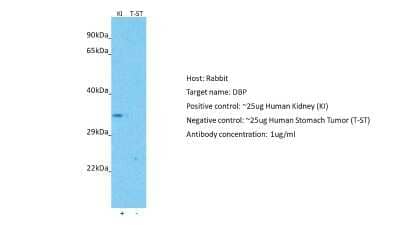 Western Blot D Box Binding Protein Antibody