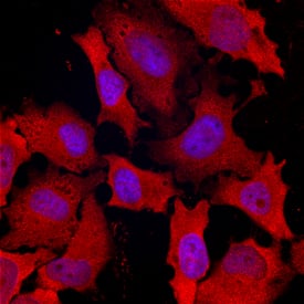 DAB2 was detected in immersion fixed HeLa human cervical epithelial carcinoma cell line using Mouse Anti-Human DAB2 Monoclonal Antibody (Catalog # MAB8064) at 10 µg/mL for 3 hours at room temperature. Cells were stained using the NorthernLights™ 557-conjugated Anti-Mouse IgG Secondary Antibody (red; Catalog # NL007) and counterstained with DAPI (blue). Specific staining was localized to cytoplasm. View our protocol for Fluorescent ICC Staining of Cells on Coverslips.