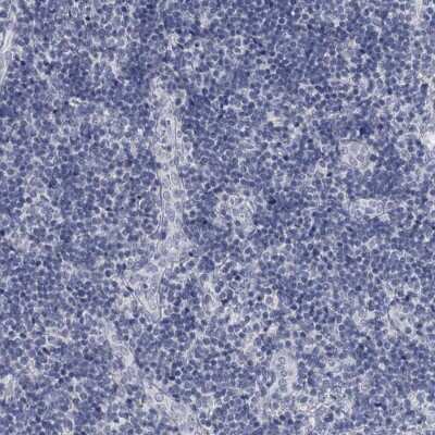 Immunohistochemistry-Paraffin: DAO Antibody [NBP1-84304] - Staining of human lymph node shows low expression as expected.