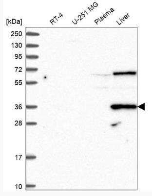 Western Blot: DAO Antibody [NBP1-84304] - Analysis in human cell line RT-4, human cell line U-251 MG, human plasma and human liver tissue.