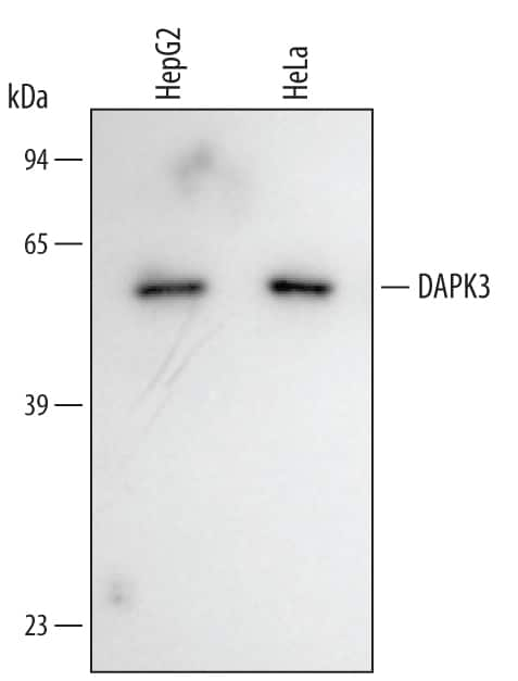 Western Blot DAPK3/ZIPK Antibody