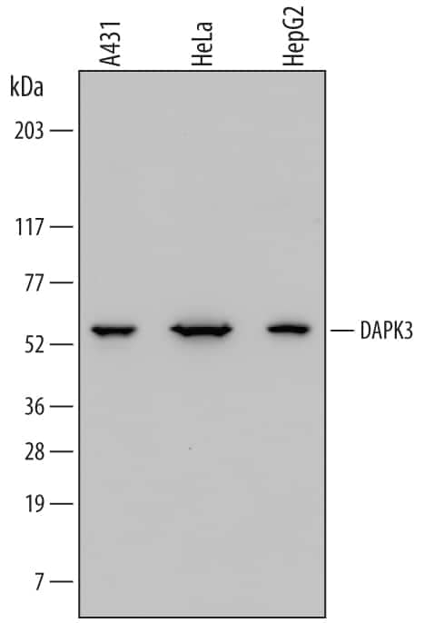 Western blot shows lysates of A431 human epithelial carcinoma cell line, HeLa human cervical epithelial carcinoma cell line, and HepG2 human hepatocellular carcinoma cell line. PVDF membrane was probed with 0.5 µg/mL of Mouse Anti-Human DAPK3/ZIPK Monoclonal Antibody (Catalog # MAB5290) followed by HRP-conjugated Anti-Mouse IgG Secondary Antibody (Catalog # HAF007). A specific band was detected for DAPK3/ZIPK at approximately 55 kDa (as indicated). This experiment was conducted under reducing conditions and using Immunoblot Buffer Group 1.