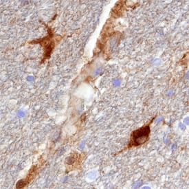 DARPP-32 was detected in immersion fixed paraffin-embedded sections of human brain (hippocampus) using Goat Anti-Human/Mouse/Rat DARPP-32 Antigen Affinity-purified Polyclonal Antibody (Catalog # AF6259) at 15 µg/mL overnight at 4 °C. Tissue was stained using the Anti-Goat HRP-DAB Cell & Tissue Staining Kit (brown; Catalog # CTS008) and counterstained with hematoxylin (blue). Specific staining was localized to neurons and glial cells. View our protocol for Chromogenic IHC Staining of Paraffin-embedded Tissue Sections.