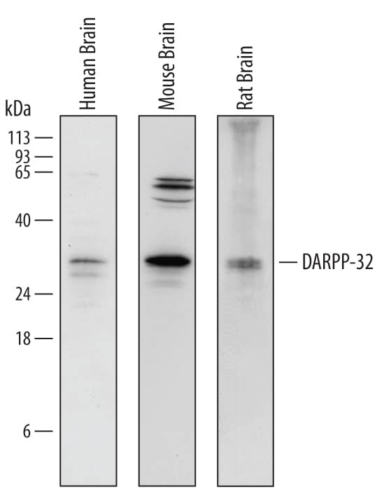 Western blot shows lysates of human brain tissue, mouse brain tissue, and rat brain tissue. PVDF Membrane was probed with 1 µg/mL of Goat Anti-Human/Mouse/Rat DARPP-32 Antigen Affinity-purified Polyclonal Antibody (Catalog # AF6259) followed by HRP-conjugated Anti-Goat IgG Secondary Antibody (Catalog # HAF109). A specific band was detected for DARPP-32 at approximately 32 - 35 kDa (as indicated). This experiment was conducted under reducing conditions and using Immunoblot Buffer Group 1.