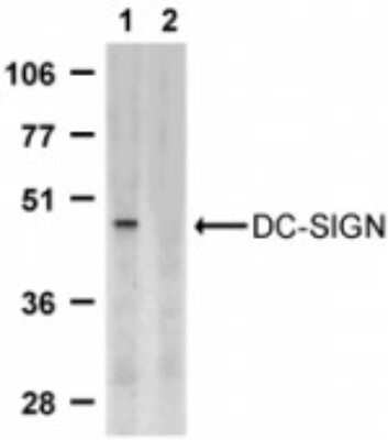 Western Blot: DC-SIGN/CD209 Antibody [NBP1-76787] - Analysis of DC-SIGN expression in human placenta tissue lysate in the absence (lane 1) and presence (lane 2) of blocking peptide with DC-SIGN antibody using this antibody at 2 ug /ml.