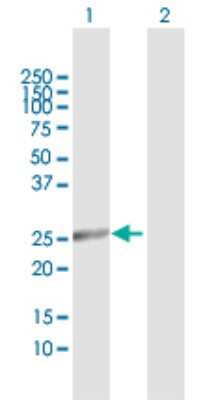 DCI Antibody (H00001632-D01P): Novus Biologicals