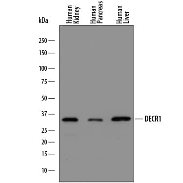 Western blot shows lysates of human kidney tissue, human pancreas tissue, and human liver tissue. PVDF membrane was probed with 0.25 µg/mL of Sheep Anti-Human/Mouse/Rat DECR1 Antigen Affinity-purified Polyclonal Antibody (Catalog # AF7976) followed by HRP-conjugated Anti-Sheep IgG Secondary Antibody (Catalog # HAF016). A specific band was detected for DECR1 at approximately 34 kDa (as indicated). This experiment was conducted under reducing conditions and using Immunoblot Buffer Group 1.