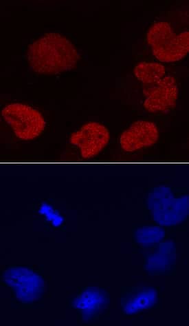 DEK was detected in immersion fixed HeLa human cervical epithelial carcinoma cell line using Mouse Anti-Human DEK Monoclonal Antibody (Catalog # MAB70201) at 10 µg/mL for 3 hours at room temperature. Cells were stained using the NorthernLights™ 557-conjugated Anti-Mouse IgG Secondary Antibody (red, upper panel; Catalog # NL007) and counterstained with DAPI (blue, lower panel). Specific staining was localized to nucleus. View our protocol for Fluorescent ICC Staining of Cells on Coverslips.