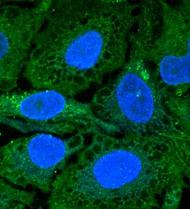 DFF40/CAD was detected in immersion fixed HeLa human cervical epithelial carcinoma cell line using Mouse Anti-Human DFF40/CAD Monoclonal Antibody (Catalog # MAB6289) at 10 µg/mL for 3 hours at room temperature. Cells were stained using the NorthernLights™ 493-conjugated Anti-Mouse IgG Secondary Antibody (green; Catalog # NL009) and counterstained with DAPI (blue). Specific staining was localized to cytoplasm. View our protocol for Fluorescent ICC Staining of Cells on Coverslips.