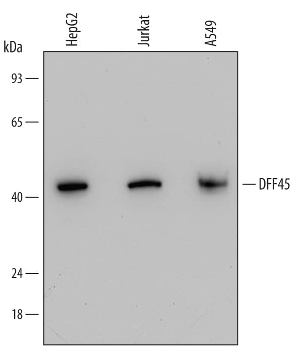 Western blot shows lysates of HepG2 human hepatocellular carcinoma cell line, Jurkat human acute T cell leukemia cell line, and A549 human lung carcinoma cell line. PVDF Membrane was probed with 0.5 µg/mL of Mouse Anti-Human DFF45/ICAD Monoclonal Antibody (Catalog # MAB4679) followed by HRP-conjugated Anti-Mouse IgG Secondary Antibody (Catalog # HAF007). A specific band was detected for DFF45/ICAD at approximately 45 kDa (as indicated). This experiment was conducted under reducing conditions and using Immunoblot Buffer Group2.