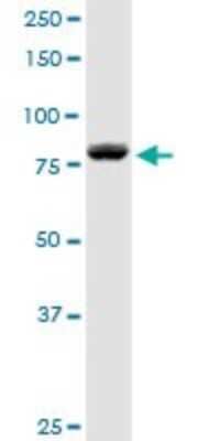 DGK-alpha Antibody (H00001606-D01P): Novus Biologicals