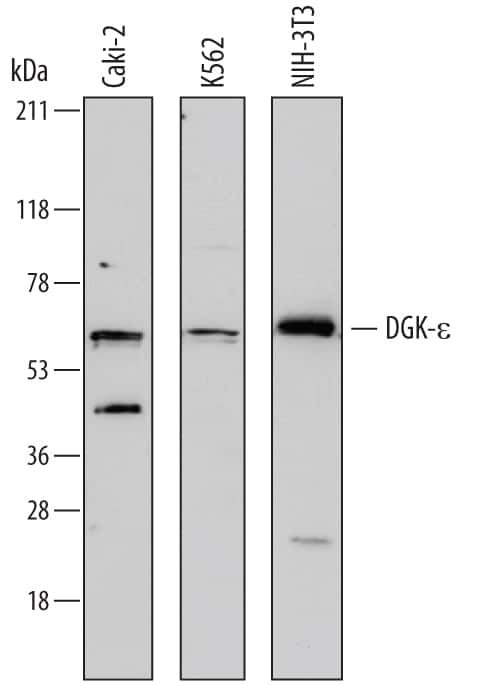 Western blot shows lysates of Caki-2 human clear cell carcinoma epithelial cell line, K562 human chronic myelogenous leukemia cell line, and NIH-3T3 mouse embryonic fibroblast cell line. PVDF membrane was probed with 1 µg/mL of Sheep Anti-Human DGK-e Antigen Affinity-purified Polyclonal Antibody (Catalog # AF7069) followed by HRP-conjugated Anti-Sheep IgG Secondary Antibody (Catalog # HAF016). A specific band was detected for DGK-e at approximately 65 kDa (as indicated). This experiment was conducted under reducing conditions and using Immunoblot Buffer Group 1.