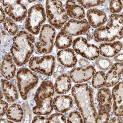 Immunohistochemistry-Paraffin: DHRS4 Antibody [NBP1-83790] - Staining of human kidney shows strong cytoplasmic positivity in tubule cells.