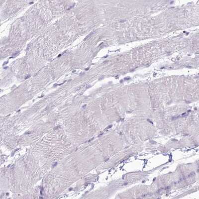 DHX40 Antibody (NBP1-91834): Novus Biologicals